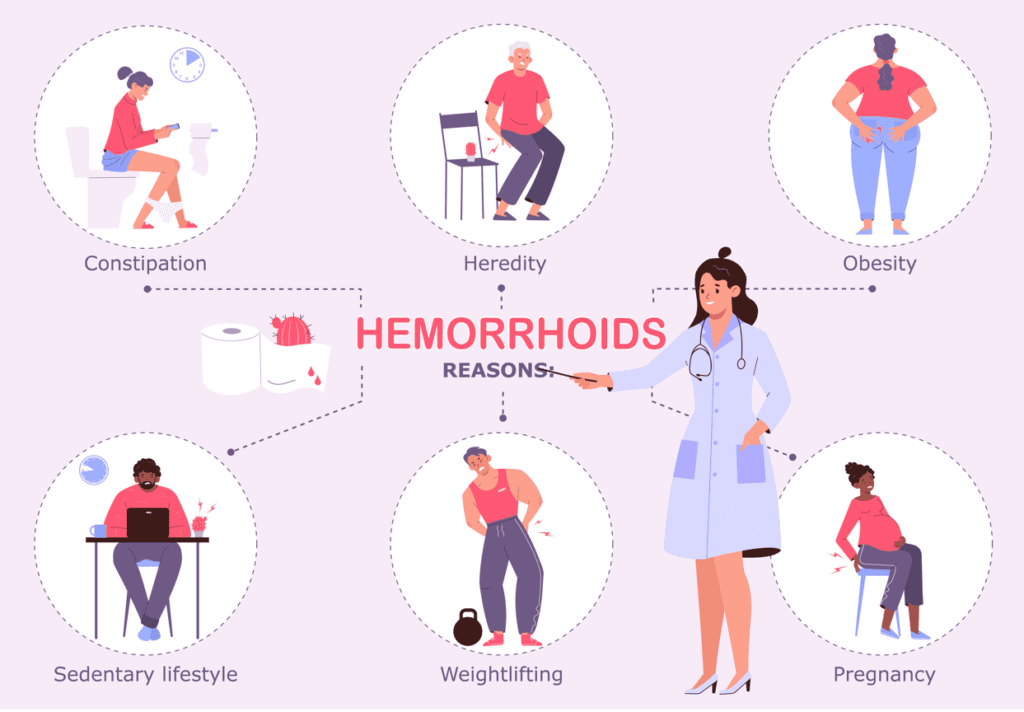 Hemoroid Nedir? Belirtileri ve Tedavi Seçenekleri