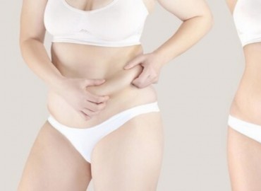 Mide Balonu ile Mide Botoksu Arasında Nasıl Bir Fark Var?