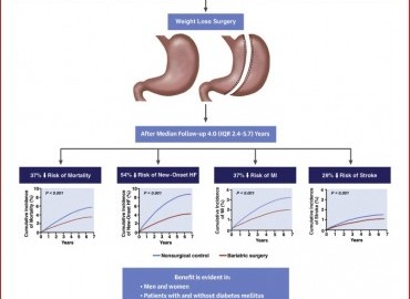 Obezite Cerrahisi ve Kemik Sağlığı: Uzun Vadeli Etkiler Neler?