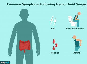 Hemoroid Ameliyatı Sonrası Bakım İpuçları