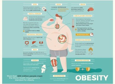  Obezitenin Neden Olduğu Hastalıklar Nelerdir?
